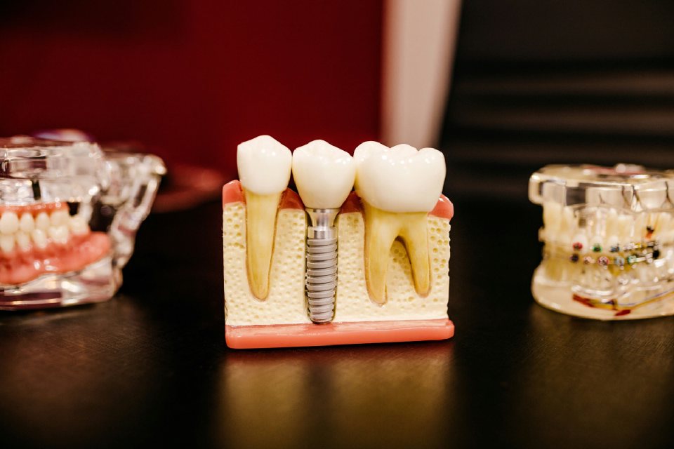 Dental model and equipment in a professional office setting